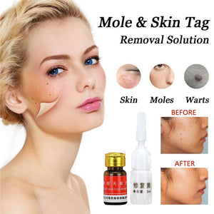 Mole Removal Solution Painless Mole Skin Dark Spot Removal Face Wart Tag Freckle Removal Cream Oil Blemish Removers