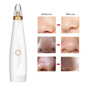 Blackhead Remover Face Deep Pore Cleaner Removal Vacuum Suction Facial SPA Diamond Beauty Care Tool Skin Care