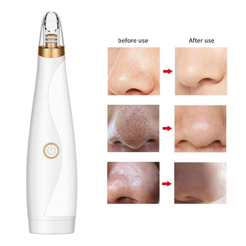 Blackhead Remover Face Deep Pore Cleaner Removal Vacuum Suction Facial SPA Diamond Beauty Care Tool Skin Care